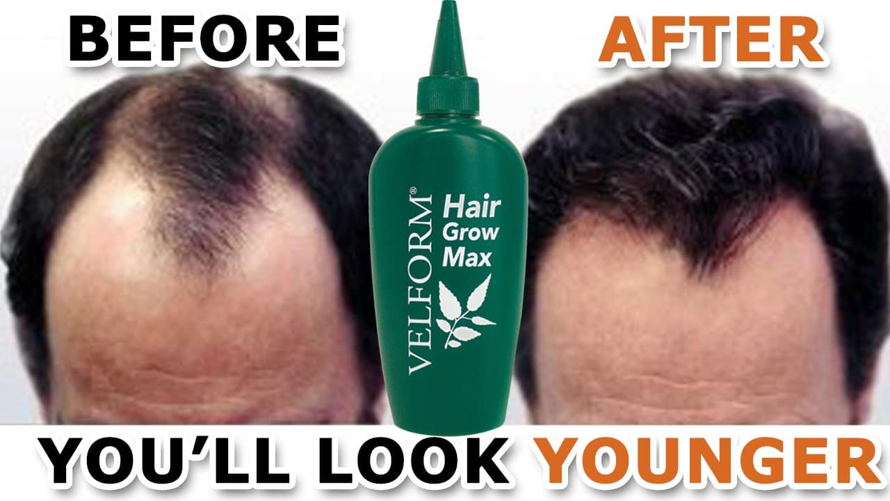 Velfrom Hair Grow Max 